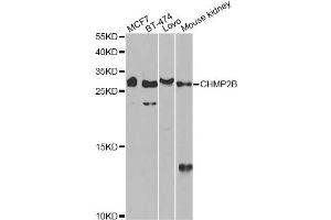 Western blot analysis of extracts of various cell lines, using CHMP2B antibody.
