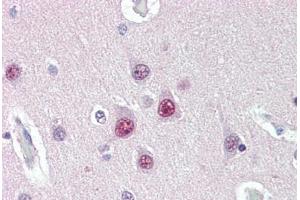 Human Brain, Cortex (formalin-fixed, paraffin-embedded) stained with UBQLN1 antibody ABIN396937 at 10 ug/ml followed by biotinylated anti-mouse IgG secondary antibody ABIN481714, alkaline phosphatase-streptavidin and chromogen. (Ubiquilin 1 anticorps  (Internal Region))