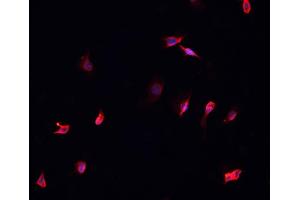 ABIN6269030 staining A-431 cells by IF/ICC.