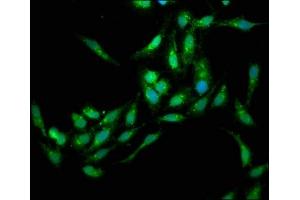 Immunofluorescence staining of Hela cells with ABIN7151786 at 1:133, counter-stained with DAPI. (EDC4 anticorps  (AA 753-952))