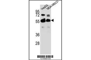 Western blot analysis in HepG2,MDA-MB231 cell line lysates (35ug/lane). (RAP1GDS1 anticorps  (AA 217-244))