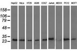 Western blot analysis of extracts (35 µg) from 9 different cell lines by using anti-AK3 monoclonal antibody. (Adenylate Kinase 3 anticorps)