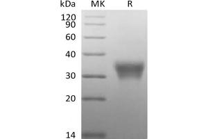 Western Blotting (WB) image for CD7 (CD7) protein (Biotin,His-Avi Tag) (ABIN7319893) (CD7 Protein (CD7) (Biotin,His-Avi Tag))