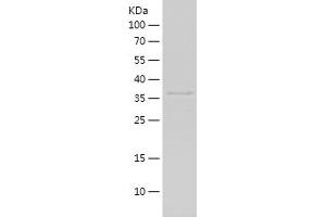 Western Blotting (WB) image for Ribosomal Protein, Large, P0 (RPLP0) (AA 33-169) protein (His-IF2DI Tag) (ABIN7124907)