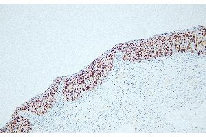 Immunohistochemistry (IHC) image for anti-Antigen Identified By Monoclonal Antibody Ki-67 (MKI67) antibody (ABIN7598807) (Ki-67 anticorps)