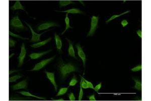 Immunofluorescence of monoclonal antibody to OXSR1 on HeLa cell.