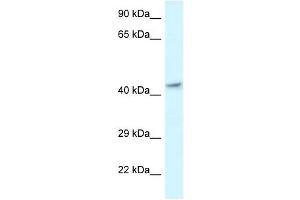 Western Blot showing MECR antibody used at a concentration of 1 ug/ml against Fetal Brain Lysate (MECR anticorps  (C-Term))