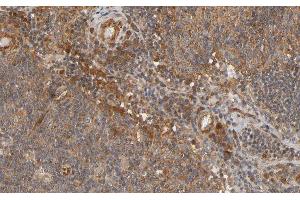ABIN6266692 at 1/100 staining human Lymph node tissue sections by IHC-P. (RANKL anticorps  (Internal Region))