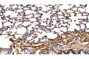 Detection of PINP in Rat Lung Tissue using Polyclonal Antibody to Procollagen I N-Terminal Propeptide (PINP)