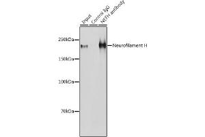 Immunoprecipitation analysis of 600 μg extracts of Mouse brain cells using 3 μg Neurofilament H antibody (ABIN6129638, ABIN6144512, ABIN6144513 and ABIN6224502). (NEFH anticorps  (AA 821-1020))