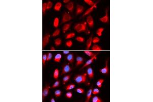 Immunofluorescence analysis of U2OS cells using UROD antibody. (UROD anticorps  (AA 1-367))