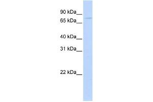 WB Suggested Anti-APP Antibody Titration:  0. (APP anticorps  (Middle Region))