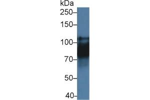 Detection of CDH16 in Rat Kidney lysate using Polyclonal Antibody to Cadherin 16 (CDH16)