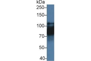 Detection of CDH16 in Rat Kidney lysate using Polyclonal Antibody to Cadherin 16 (CDH16) (Cadherin-16 anticorps  (AA 353-617))
