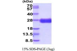 SDS-PAGE (SDS) image for CD7 (CD7) (AA 26-180) protein (His tag) (ABIN5854880)