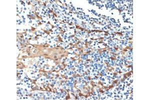 Immunohistochemistry of paraffin-embedded Human tonsil using HSPA1A Monoclonal Antibody at dilution of 1:100 (40x lens).