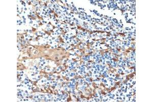 Immunohistochemistry of paraffin-embedded Human tonsil using HSPA1A Monoclonal Antibody at dilution of 1:100 (40x lens). (HSP70 1A anticorps)
