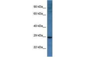 Image no. 1 for anti-BCL2/adenovirus E1B 19kDa Interacting Protein 3-Like (BNIP3L) (AA 92-141) antibody (ABIN6747290) (BNIP3L/NIX anticorps  (AA 92-141))