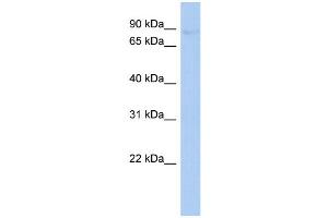 WB Suggested Anti-PLOD2 Antibody Titration:  0. (PLOD2 anticorps  (Middle Region))