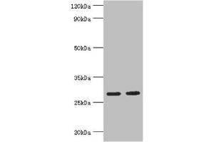 Western blot All lanes: Ubiquitin-conjugating enzyme E2 J2 antibody at 5 μg/mL Lane 1: HepG2 whole cell lysate Lane 2: Rat small intestine tissue Secondary Goat polyclonal to rabbit IgG at 1/10000 dilution Predicted band size: 29, 25, 31 kDa Observed band size: 29 kDa (UBE2J2 anticorps  (AA 1-230))