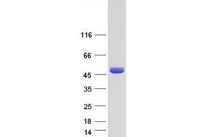 Validation with Western Blot