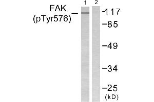Western blot analysis of extracts from NIH/3T3 cells, using FAK (Phospho-Tyr576) Antibody (#A0426).