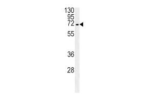 SLC22A1 Antibody (C-term) (ABIN657865 and ABIN2846821) western blot analysis in HepG2 cell line lysates (35 μg/lane).
