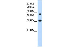 WB Suggested Anti-HOXC11 Antibody Titration:  1. (HOXC11 anticorps  (Middle Region))