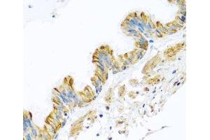 Immunohistochemistry of paraffin-embedded Human trachea using PCDHA12 Polyclonal Antibody at dilution of 1:100 (40x lens). (PCDHA12 anticorps)