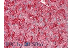 IHC-P analysis of Human Liver Tissue, with HE staining. (Annexin IV anticorps  (AA 11-164))