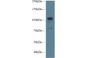 Western Blot; Sample: Human A549 cell lysate; Primary Ab: 1µg/ml Rabbit Anti-Rat NOS1 Antibody Second Ab: 0.