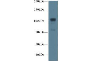 Western Blot; Sample: Human A549 cell lysate; Primary Ab: 1µg/ml Rabbit Anti-Rat NOS1 Antibody Second Ab: 0.