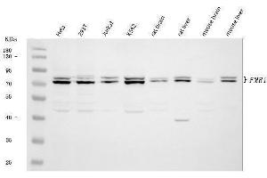 Western blot analysis of FMRP/FMR1 using anti-FMRP/FMR1 antibody (ABIN3042398).