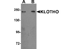Western Blotting (WB) image for anti-Klotho (KL) (Middle Region) antibody (ABIN1030975) (Klotho anticorps  (Middle Region))