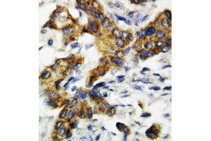Anti-BAK antibody, IHC(P) IHC(P): Rat Lung Tissue (BAK1 anticorps  (Middle Region))