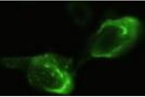 Anti-NEUROG3 mouse monoclonal antibody (NEUROG3) immunofluorescent staining of HeLa cells transiently transfected by pCMV6-ENTRY NEUROG3 (RC224767).