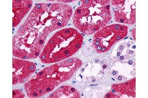 Anti-PTGER2 / EP2 antibody IHC of human kidney.