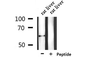 Western blot analysis of extracts from rat liver, using PLAT Antibody. (PLAT anticorps  (C-Term))