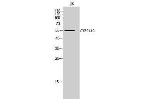 Western Blotting (WB) image for anti-Cytochrome P450, Family 21, Subfamily A, Polypeptide 2 (CYP21A2) (Internal Region) antibody (ABIN3184165) (CYP21A2 anticorps  (Internal Region))