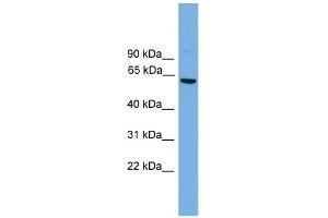 WB Suggested Anti-Cbfa2t2 Antibody Titration:  0. (CBFA2T2 anticorps  (Middle Region))