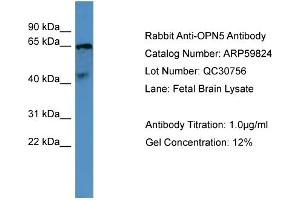 WB Suggested Anti-OPN5  Antibody Titration: 0.