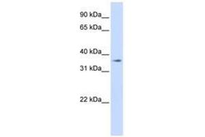 Image no. 1 for anti-Transmembrane Protein 30B (TMEM30B) (AA 108-157) antibody (ABIN6740901) (TMEM30B anticorps  (AA 108-157))