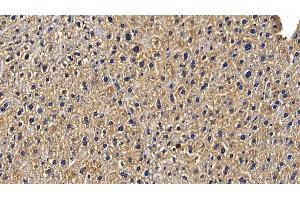 Detection of TRAF6 in Mouse Liver Tissue using Polyclonal Antibody to TNF Receptor Associated Factor 6 (TRAF6)