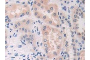 Detection of CDA in Human Kidney Tissue using Polyclonal Antibody to Cytidine Deaminase (CDA)