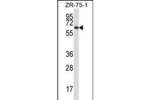 P17 Antibody (C-term) (ABIN657916 and ABIN2846863) western blot analysis in ZR-75-1 cell line lysates (35 μg/lane). (MMP17 anticorps  (C-Term))