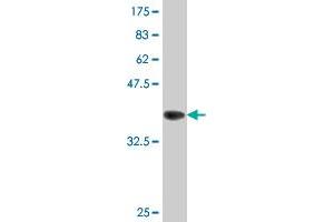 Western Blot detection against Immunogen (36. (ATG5 anticorps  (AA 176-275))