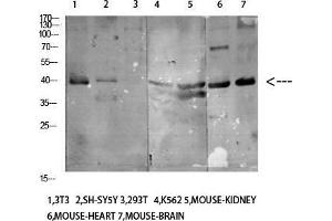 Western Blot (WB) analysis of specific cells using Antibody diluted at 1:1000. (KIR3DL1 anticorps)