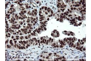 Image no. 5 for anti-Ubiquitin-Conjugating Enzyme E2E 3 (UBE2E3) antibody (ABIN1501618)