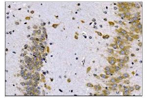 IHC analysis of SCN1B using anti-SCN1B antibody (ABIN7600600).