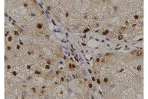 ABIN6269310 at 1/100 staining Human liver tissue by IHC-P. (RUNX1 anticorps  (Internal Region))